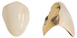 prevleka-fasetirana kopija