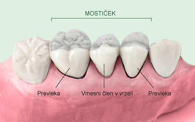 mosticek 01